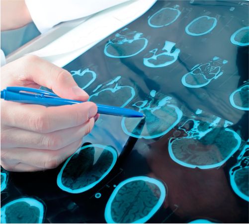 Centro Médico Medex | Neurología