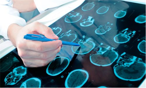 Centro Médico Medex | Neurología